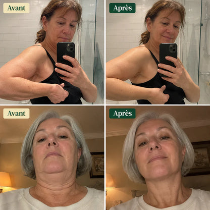Lynuvia® Drainant Lymphatique
